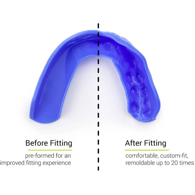 Sisu 3D Mouth Guard (One Size|Hot Pink)